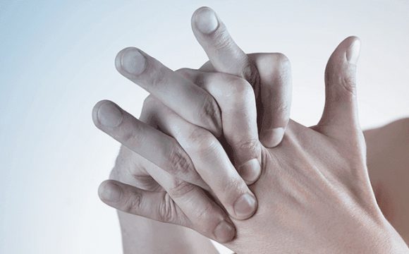 Romatoid Artrit (İltihaplı Romatizma) Tedavisi – Tüm Soru Cevaplar