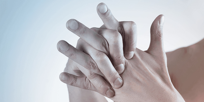Romatoid Artrit (İltihaplı Romatizma) Tedavisi – Tüm Soru Cevaplar
