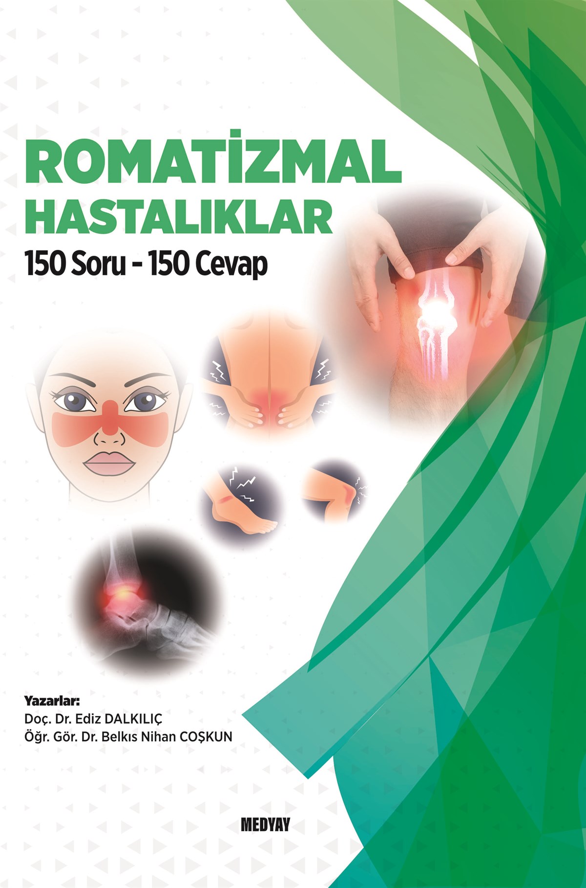 romatizmal-hastaliklar-150-soru-150-ce–4c63-